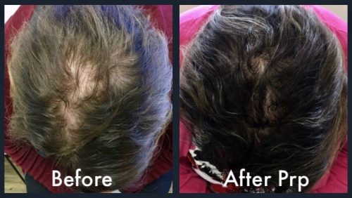 Before-and-After-hair